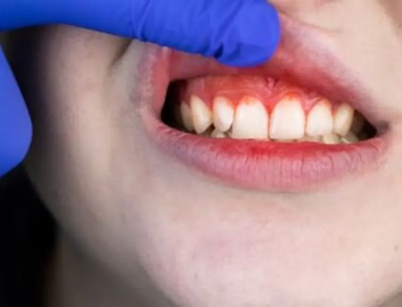 persons teeth and gums