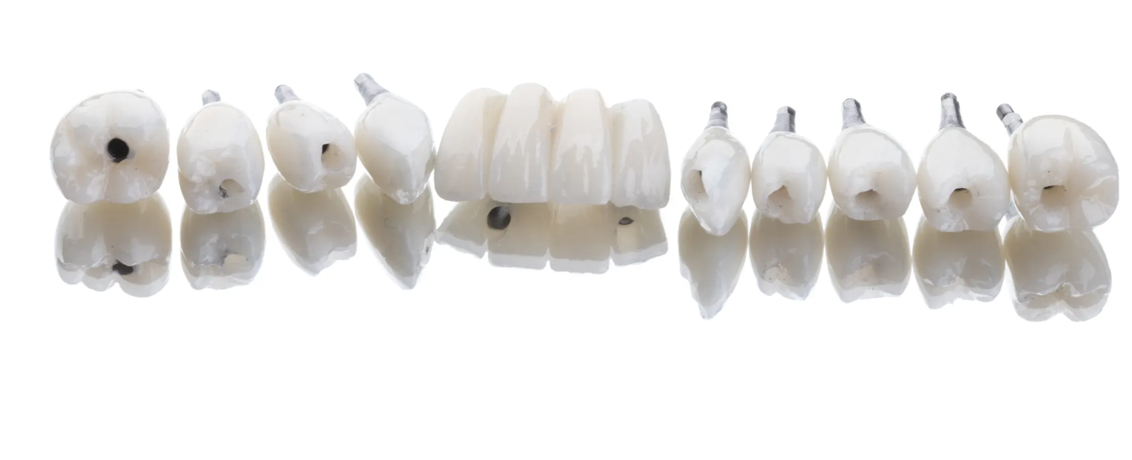 Dental Implant Crowns